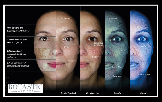 Revolutionary skin scanner